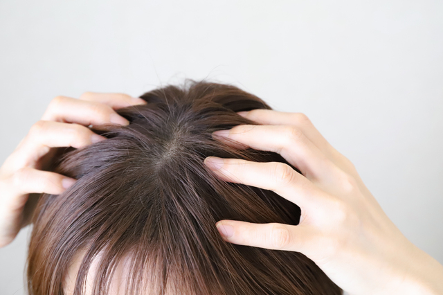 薄毛に悩む方