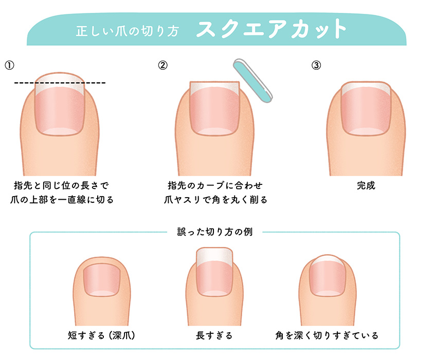 正しい爪の切り方