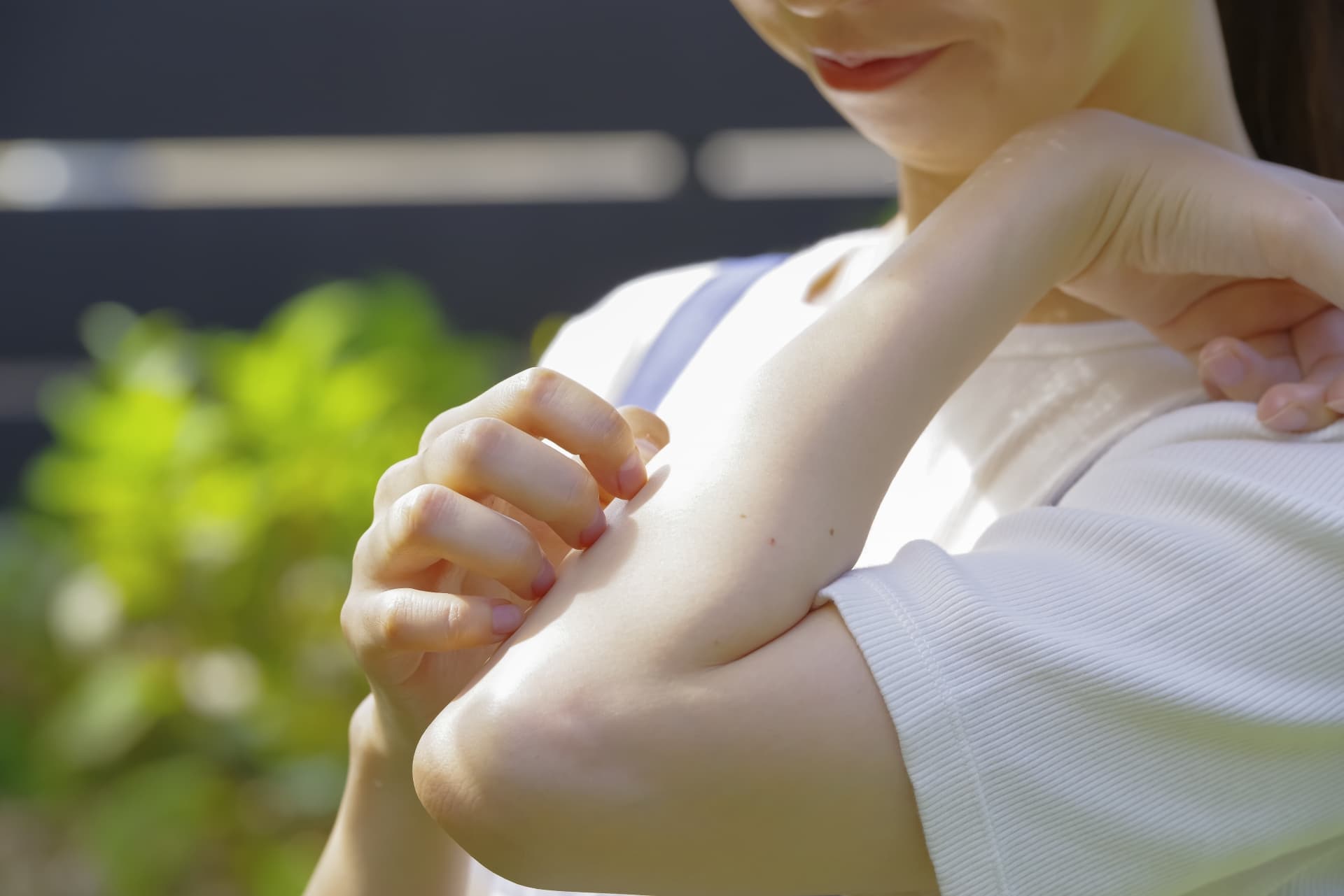 虫刺されに悩む人